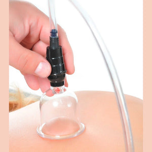 Set di 6 campane per cupping