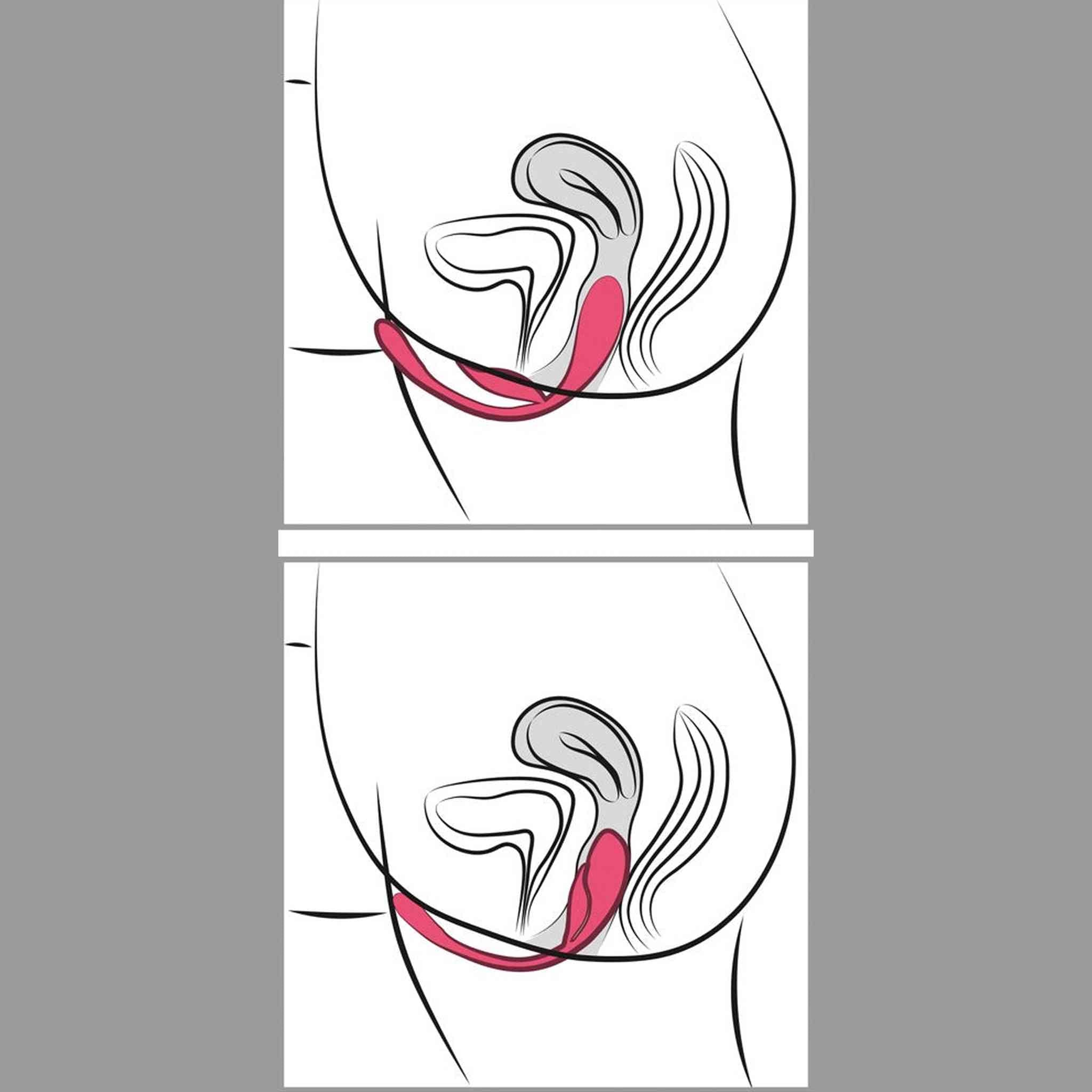 Vibratore Telcomandato Triple Way
